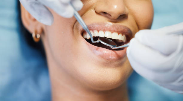 Best Emergency Dental Care for Sports Injuries in Bidwell, OH